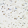 Immunohistochemistry of paraffin-embedded Rat brain using SFPQ Polyclonal Antibody at dilution of  1:100 (40x lens).