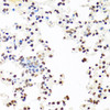 Immunohistochemistry of paraffin-embedded Mouse lung using SFPQ Polyclonal Antibody at dilution of  1:100 (40x lens).