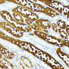 Immunohistochemistry of paraffin-embedded Mouse kidney using Caspase-1 Polyclonal Antibody at dilution of  1:100 (40x lens).