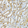 Immunohistochemistry of paraffin-embedded Rat kidney using Caspase-1 Polyclonal Antibody at dilution of  1:100 (40x lens).