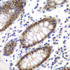 Immunohistochemistry of paraffin-embedded Human colon using MSH6 Polyclonal Antibody at dilution of  1:100 (40x lens).