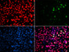 Immunofluorescence analysis of GFP-RNF168 transgenic U2OS cells using MSH6 Polyclonal Antibody