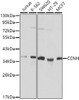 Western blot analysis of extracts of various cell lines using CCNH Polyclonal Antibody.