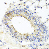 Immunohistochemistry of paraffin-embedded Mouse lung using MUC16 Polyclonal Antibody at dilution of  1:100 (40x lens).