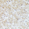 Immunohistochemistry of paraffin-embedded Mouse heart using YAP1 Polyclonal Antibody at dilution of  1:100 (40x lens).