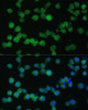 Immunofluorescence analysis of THP-1 cells using CR1 Polyclonal Antibody at dilution of  1:100. Blue: DAPI for nuclear staining.