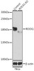 Western blot analysis of extracts from normal (control) and ROCK1 knockout (KO) HeLa cells using ROCK1 Polyclonal Antibody at dilution of 1:1000.