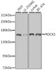 Western blot analysis of extracts of various cell lines using ROCK1 Polyclonal Antibody at dilution of 1:1000.