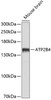 Western blot analysis of extracts of Mouse brain using ATP2B4 Polyclonal Antibody at dilution of 1:1000.