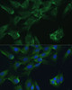 Immunofluorescence analysis of C6 cells using ADA Polyclonal Antibody at dilution of  1:100. Blue: DAPI for nuclear staining.