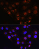 Immunofluorescence analysis of C6 cells using GOLGA4 Polyclonal Antibody at dilution of  1:100 (40x lens). Blue: DAPI for nuclear staining.