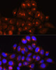 Immunofluorescence analysis of HeLa cells using GOLGA4 Polyclonal Antibody at dilution of  1:100 (40x lens). Blue: DAPI for nuclear staining.