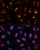 Immunofluorescence analysis of U2OS cells using CytokeRatin-18 Polyclonal Antibody at dilution of  1:100. Blue: DAPI for nuclear staining.