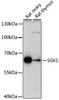 Western blot analysis of extracts of various cell lines using SGK1 Polyclonal Antibody at dilution of 1:1000.