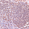 Immunohistochemistry of paraffin-embedded Human tonsil using TPD52 Polyclonal Antibody at dilution of  1:100 (40x lens).