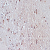 Immunohistochemistry of paraffin-embedded Rat brain using TPD52 Polyclonal Antibody at dilution of  1:100 (40x lens).