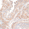 Immunohistochemistry of paraffin-embedded Rat ovary using KIF14 Polyclonal Antibody at dilution of  1:100 (40x lens).