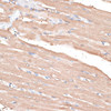 Immunohistochemistry of paraffin-embedded Rat heart using KIF14 Polyclonal Antibody at dilution of  1:100 (40x lens).