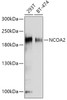 Western blot analysis of extracts of various cell lines using NCOA2 Polyclonal Antibody at dilution of 1:1000.