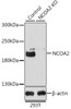 Western blot analysis of extracts from normal (control) and NCOA2 knockout (KO) 293T cells using NCOA2 Polyclonal Antibody at dilution of 1:1000.