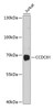 Western blot analysis of extracts of Jurkat cells using CCDC61 Polyclonal Antibody at dilution of 1:1000.