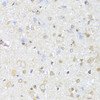 Immunohistochemistry of paraffin-embedded Rat brain using EGLN1/EGLN2 Polyclonal Antibody at dilution of  1:100 (40x lens).