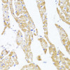 Immunohistochemistry of paraffin-embedded Rat heart using EGLN1/EGLN2 Polyclonal Antibody at dilution of  1:100 (40x lens).
