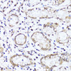Immunohistochemistry of paraffin-embedded Human stomach using EGLN1/EGLN2 Polyclonal Antibody at dilution of  1:100 (40x lens).