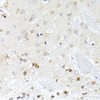 Immunohistochemistry of paraffin-embedded Mouse brain using EGLN1/EGLN2 Polyclonal Antibody at dilution of  1:100 (40x lens).