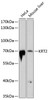 Western blot analysis of extracts of various cell lines using KRT2 Polyclonal Antibody at dilution of 1:1000.