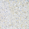 Immunohistochemistry of paraffin-embedded Rat liver using SLC4A5 Polyclonal Antibody at dilution of  1:100 (40x lens).