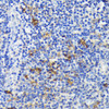 Immunohistochemistry of paraffin-embedded Human tonsil using TREM2 Polyclonal Antibody at dilution of  1:200 (40x lens).