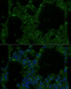 Immunofluorescence analysis of Rat lung using TREM2 Polyclonal Antibody at dilution of  1:100. Blue: DAPI for nuclear staining.