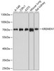 Western blot analysis of extracts of various cell lines using KREMEN1 Polyclonal Antibody at dilution of 1:1000.