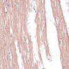 Immunohistochemistry of paraffin-embedded Rat heart using COL11A1 Polyclonal Antibody at dilution of  1:100 (40x lens).