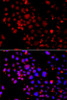 Immunofluorescence analysis of A549 cells using Slug Polyclonal Antibody