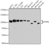 Western blot analysis of extracts of various cell lines using PARG Polyclonal Antibody at dilution of 1:7000.