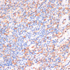 Immunohistochemistry of paraffin-embedded Human tonsil using CYBA Polyclonal Antibody at dilution of  1:100 (40x lens).