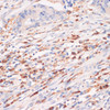 Immunohistochemistry of paraffin-embedded Human colon carcinoma using CYBA Polyclonal Antibody at dilution of  1:100 (40x lens).