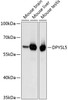 Western blot analysis of extracts of various cell lines using DPYSL5 Polyclonal Antibody at dilution of 1:3000.