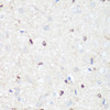 Immunohistochemistry of paraffin-embedded Rat brain using p38 MAPK Polyclonal Antibody at dilution of  1:100 (40x lens).