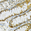 Immunohistochemistry of paraffin-embedded Human colon using HSP90AB1 Polyclonal Antibody at dilution of  1:100 (40x lens).