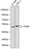 Western blot analysis of extracts of various cell lines using TYMP Polyclonal Antibody at dilution of 1:1000.