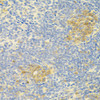 Immunohistochemistry of paraffin-embedded Mouse spleen using APP Polyclonal Antibody at dilution of  1:100 (40x lens).