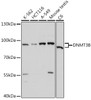 Western blot analysis of extracts of various cell lines using DNMT3B Polyclonal Antibody at dilution of 1:1000.