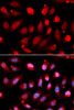 Immunofluorescence analysis of U2OS cells using EZH2 Polyclonal Antibody