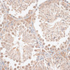 Immunohistochemistry of paraffin-embedded Mouse testis using VEGF Receptor 2 Polyclonal Antibody at dilution of  1:100 (40x lens).