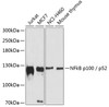 Western blot analysis of extracts of various cell lines using NFkB p100 / p52 Polyclonal Antibody at dilution of 1:1000.