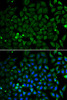 Immunofluorescence analysis of A549 cells using Parkin Polyclonal Antibody