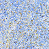Immunohistochemistry of paraffin-embedded Mouse spleen using PD-L1 Polyclonal Antibody at dilution of  1:100 (40x lens).